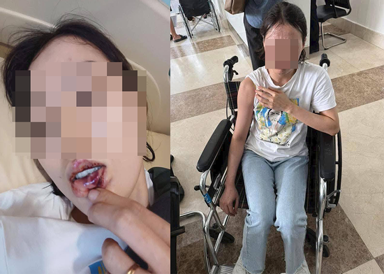 Xác minh clip chủ quán cà phê xông vào tận nhà hành hung cô gái ở TPHCM