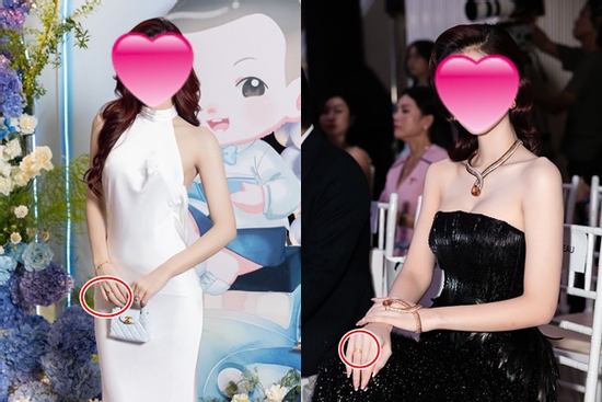 Á hậu nghi sinh con cho bác sĩ thẩm mỹ bị soi đeo nhẫn ngón áp út, công khai rồi đây!