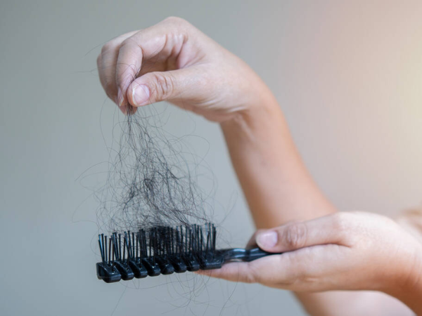 4 sai lầm khi gội đầu khiến tóc chăm mãi không đẹp mà còn rụng như lá mùa thu - Ảnh 2