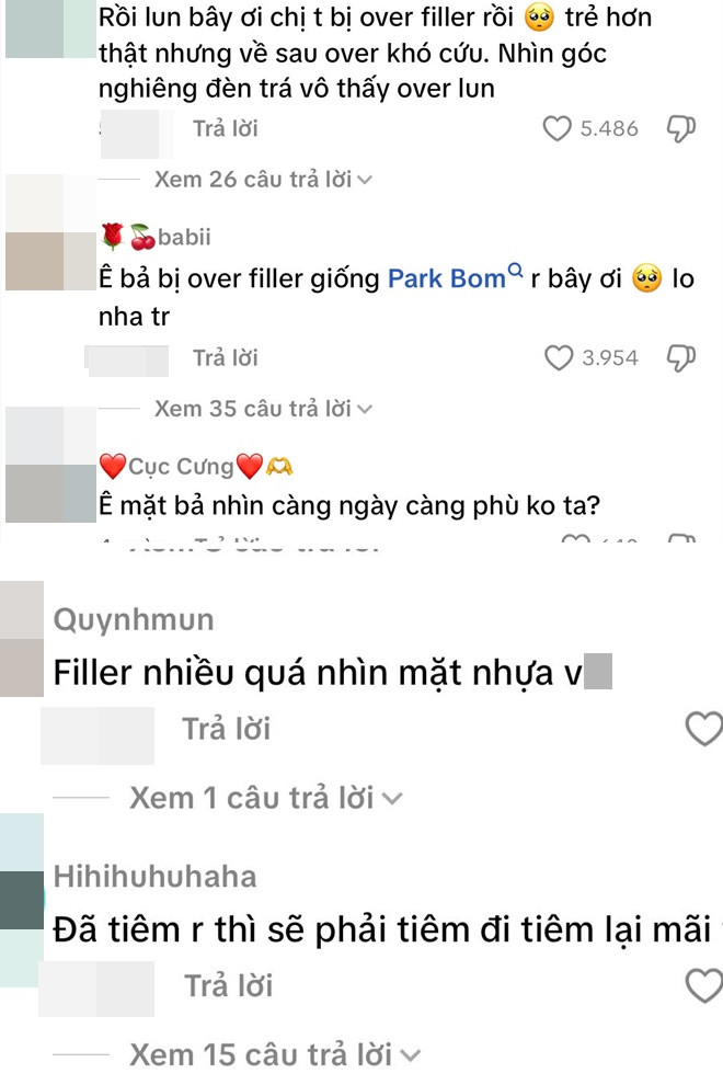 Bích Phương bị chê thảm họa thẩm mỹ với clip cam thường lộ nhan sắc thật