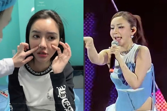 Bích Phương bị chê 'thảm họa thẩm mỹ' với clip cam thường lộ nhan sắc thật