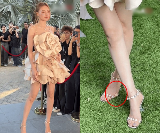 Lan Ngọc để lộ thứ bầm dập nhất cơ thể sau chấn thương phải ngồi xe lăn