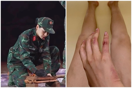 Chi Pu bầm tím tay sau màn bung sức phá gạch