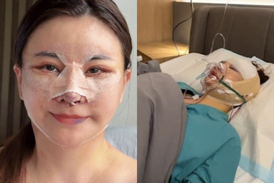 Diễn viên 'đanh đá nhất Việt Nam' nói gì về việc trùng tu cả mặt gây bàn tán khắp MXH?