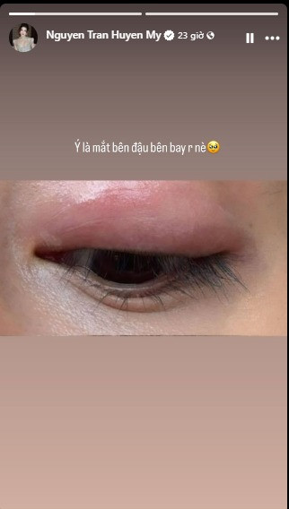 Thót tim cảnh Á hậu Vbiz té ngã trong biệt thự bạc tỷ