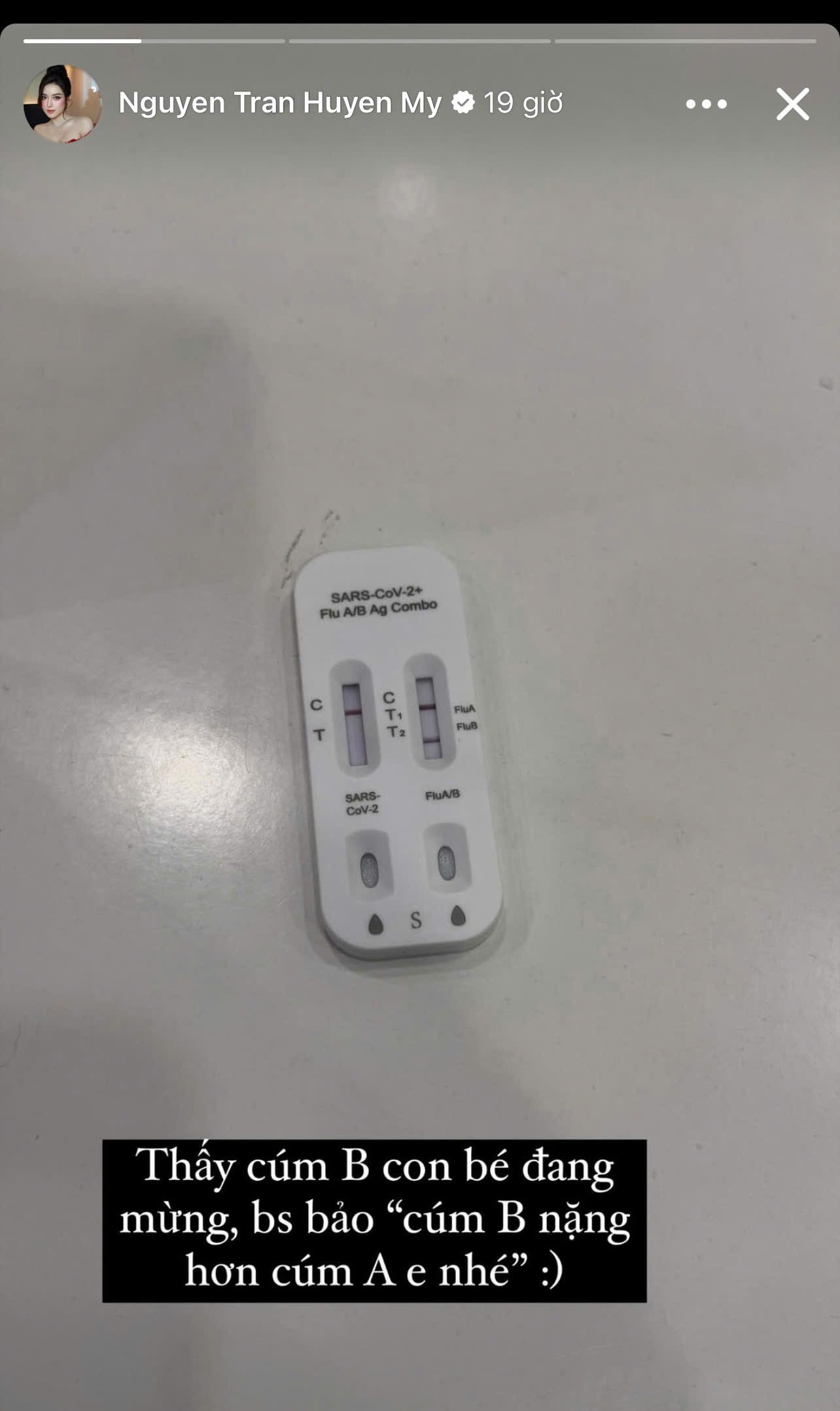 Thót tim cảnh Á hậu Vbiz té ngã trong biệt thự bạc tỷ