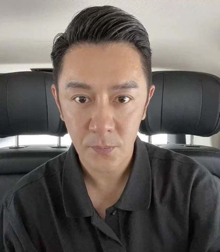 Việc lạm dụng thẩm mỹ khiến gương mặt Trần Hạo Dân ngày càng khác lạ,