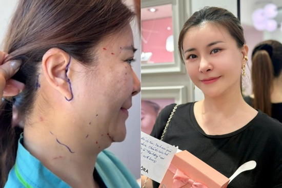 Nhan sắc hiện tại của diễn viên Kim Oanh sau khi chi 1 tỷ phẫu thuật thẩm mỹ