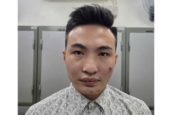 Lời khai bất ngờ của nam thanh niên sinh năm 2003 say xỉn, lái xe máy tông ngã cán bộ Công an làm nhiệm vụ A80