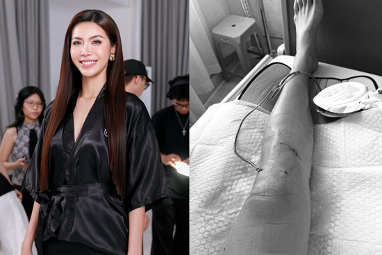 Minh Tú bị chấn thương nghiêm trọng: Dập xương, rách sụn, đứt dây chằng