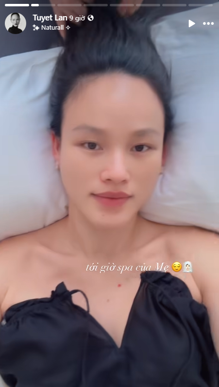 Siêu mẫu đình đám Vbiz lộ mặt mộc khác lạ sau 1 tuần sinh con