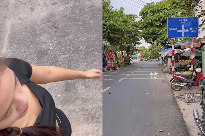 Á hậu Minh Nhàn hiện ra sao sau mổ u cột sống ở tuổi 24