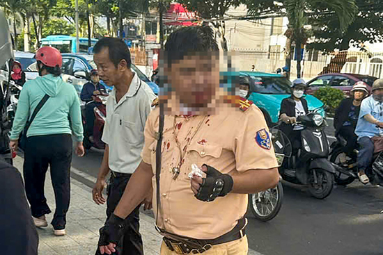 Trung tá CSGT ở Nha Trang bị người nước ngoài đấm vào mặt khi đang làm nhiệm vụ