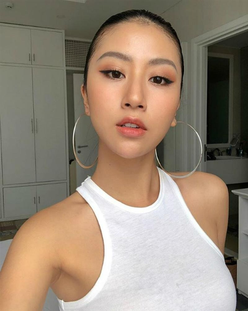 Quỳnh Anh Shyn phẫu thuật thẩm mỹ