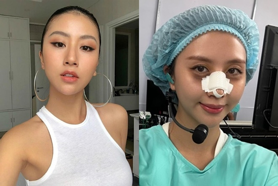 Quỳnh Anh Shyn vừa phẫu thuật thẩm mỹ?