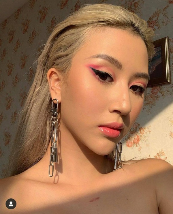 Quỳnh Anh Shyn phẫu thuật thẩm mỹ