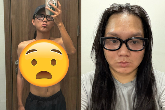 Diện mạo tiều tụy trầm trọng gây sốc của Phạm Thoại sau liên hoàn drama