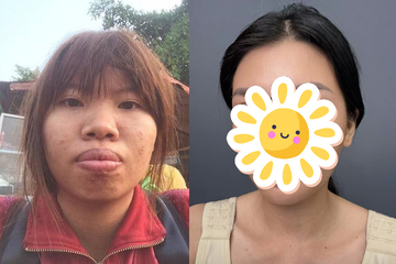 Giật mình diện mạo hiện tại của 'Thị Nở tái sinh' Quách Phượng sau 8 năm 'dao kéo'