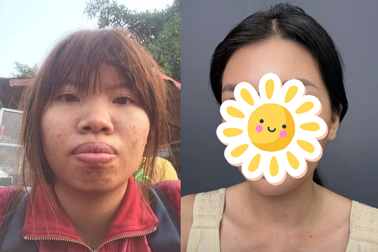 Giật mình diện mạo hiện tại của 'Thị Nở tái sinh' Quách Phượng sau 8 năm 'dao kéo'