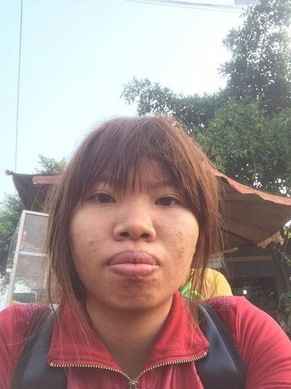 Giật mình diện mạo hiện tại của thị nở tái sinh Quách Phượng sau 8 năm dao kéo