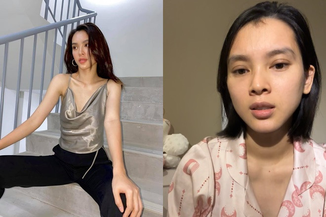 Quỳnh Lương công khai phẫu thuật nâng ngực, chi phí 'bằng 1 con Vision'