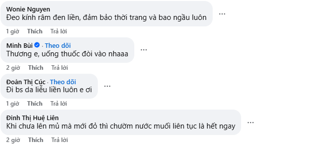 Á hậu Kiều Loan gây hoang mang với gương mặt sưng vù