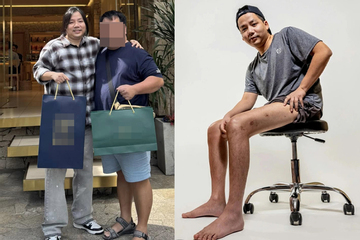 Sốc ngoại hình 'trên ngắn dưới dài' của Khoa Pug sau 2 lần chi tiền tỷ phẫu thuật kéo chân