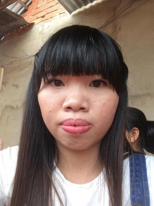 Thị Nở tái sinh Quách Phượng tiếp tục phẫu thuật thẩm mỹ diện mạo mới gây bất ngờ