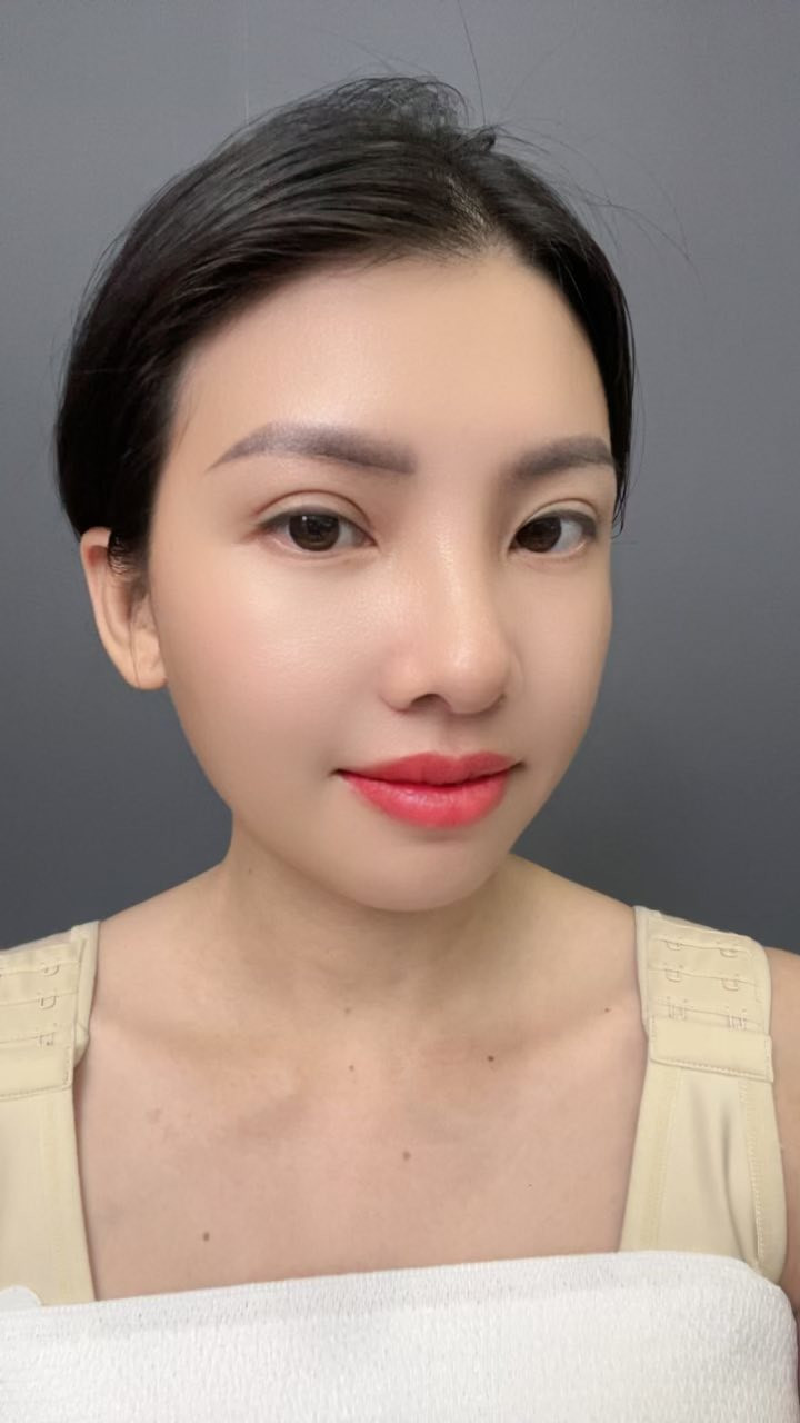 Thị Nở tái sinh Quách Phượng tiếp tục phẫu thuật thẩm mỹ diện mạo mới gây bất ngờ