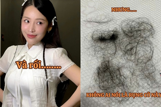 Puka tiết lộ tình trạng rụng tóc trầm trọng sau sinh