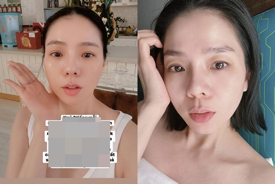 Lệ Quyên can thiệp thẩm mỹ ở tuổi U50?