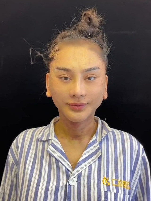 Cận gương mặt Lâm Khánh Chi sau khi sang Thượng Hải đại trùng tu nhan sắc lần n