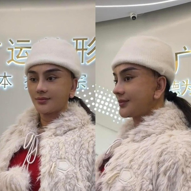 Cận gương mặt Lâm Khánh Chi sau khi sang Thượng Hải đại trùng tu nhan sắc lần n