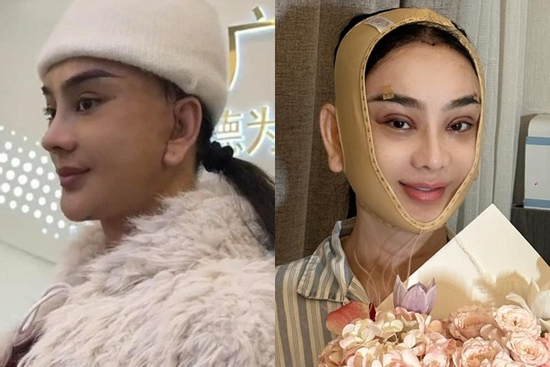 Trùng tu chục lần vẫn chưa dừng, Lâm Khánh Chi nói gì khi được khuyên bớt 'nghiện dao kéo' lại?