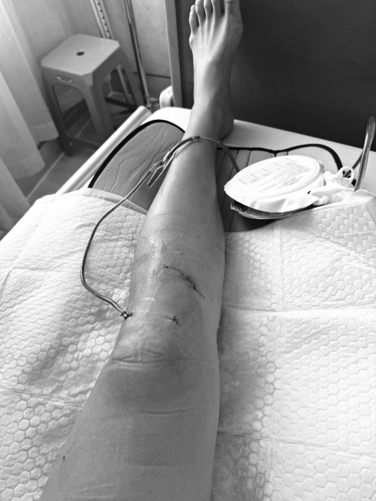 Minh Tú khoe dáng cực bạo sau thời gian tạm giải nghệ chôn chân ở nhà vì dập xương