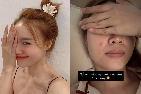 Giật mình mặt mộc đầy khuyết điểm của Ninh Dương Lan Ngọc