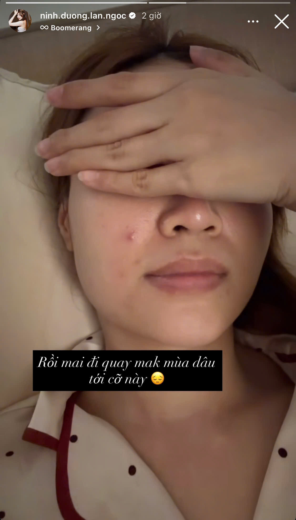 Ninh Dương Lan Ngọc lộ mặt mộc đầy khuyết điểm gây thất vọng