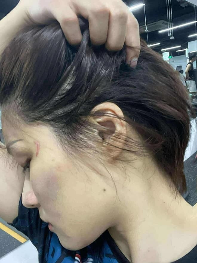 Cuộc sống thay đổi chóng mặt của cô gái hạ gục thanh niên xăm trổ trong hầm gửi xe