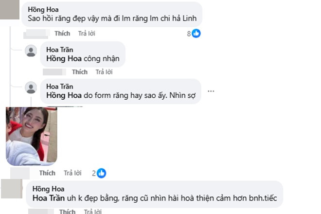 Ảnh cũ để lộ nhan sắc khác lạ vì thẩm mỹ của Lương Thùy Linh netizen tiếc nuối