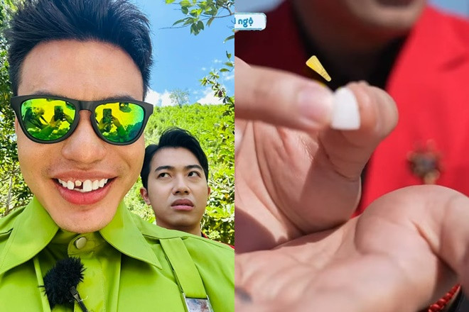 Chi Pu độn thổ vì gặp tai nạn với răng cửa netizen lập tức gọi tên Lê Dương Bảo Lâm