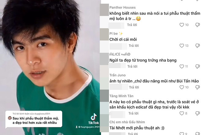 Mỹ nam hot nhất Mưa Đỏ bị nghi phẫu thuật thẩm mỹ để có visual đẹp như Lee Min Ho