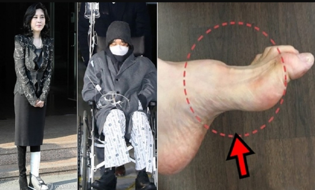 can benh o samsung 2