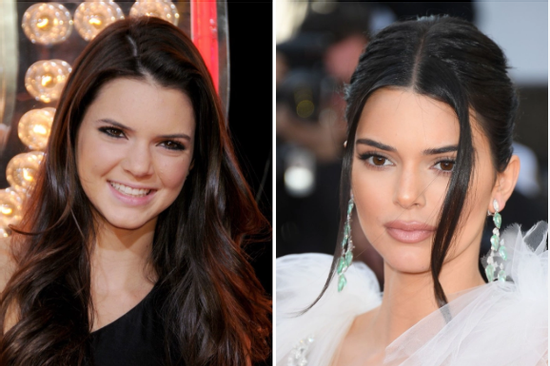Kendall Jenner mà đẹp tự nhiên sao?