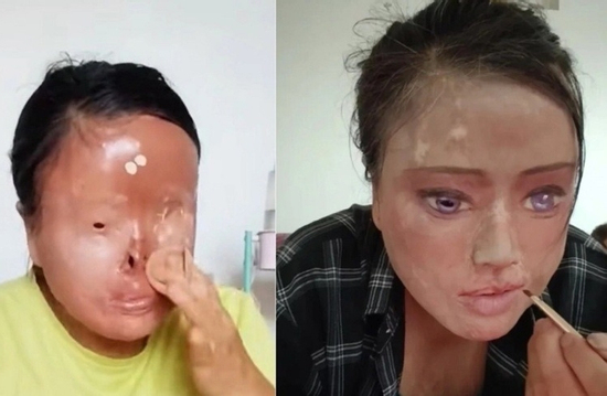 Bị chồng cũ tạt axit gây biến dạng, người phụ nữ tự vẽ lại mặt, sống cuộc đời mới