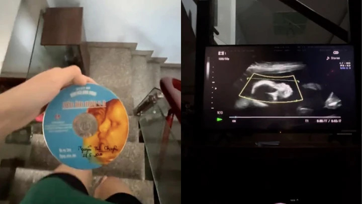 Tác giả nâng niu chiếc đĩa CD ghi hình mình lúc còn trong bụng mẹ. (Ảnh chụp màn hình)