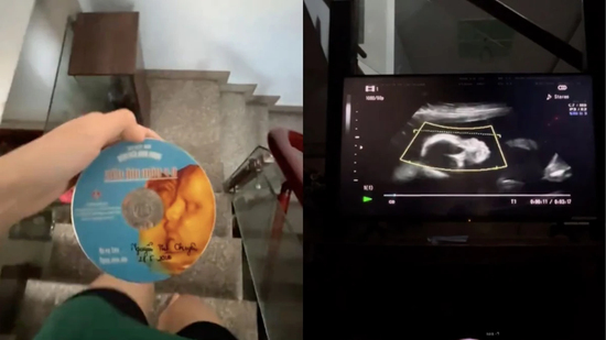 Clip siêu âm thai vừa tìm thấy và tâm thư người con làm dân mạng 'cay sống mũi'