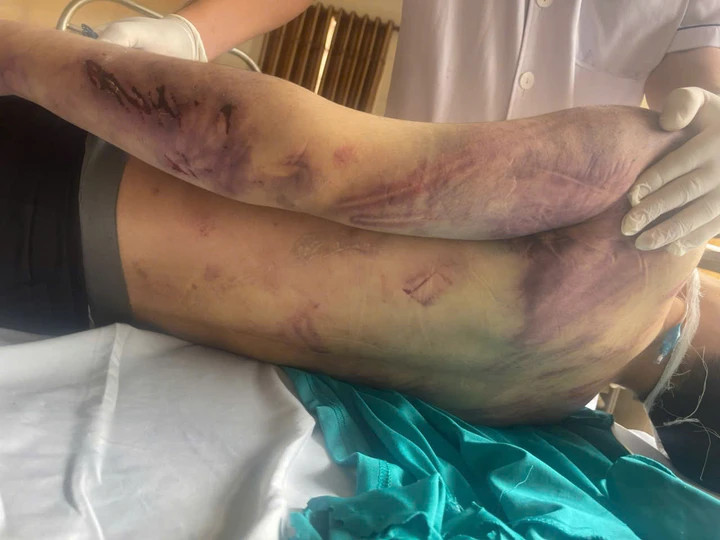 Nam học viên tử vong sau 2 ngày nhập học tại Trung tâm công tác xã hội Hải Hà, tỉnh Quảng Ninh với nhiều vết thương trên cơ thể.