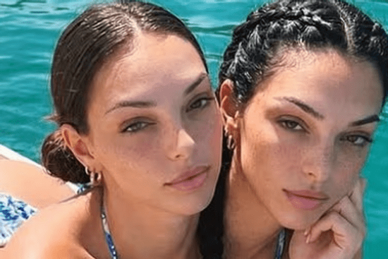 Sự thật khó tin về cặp song sinh dính liền thân đang gây bão mạng