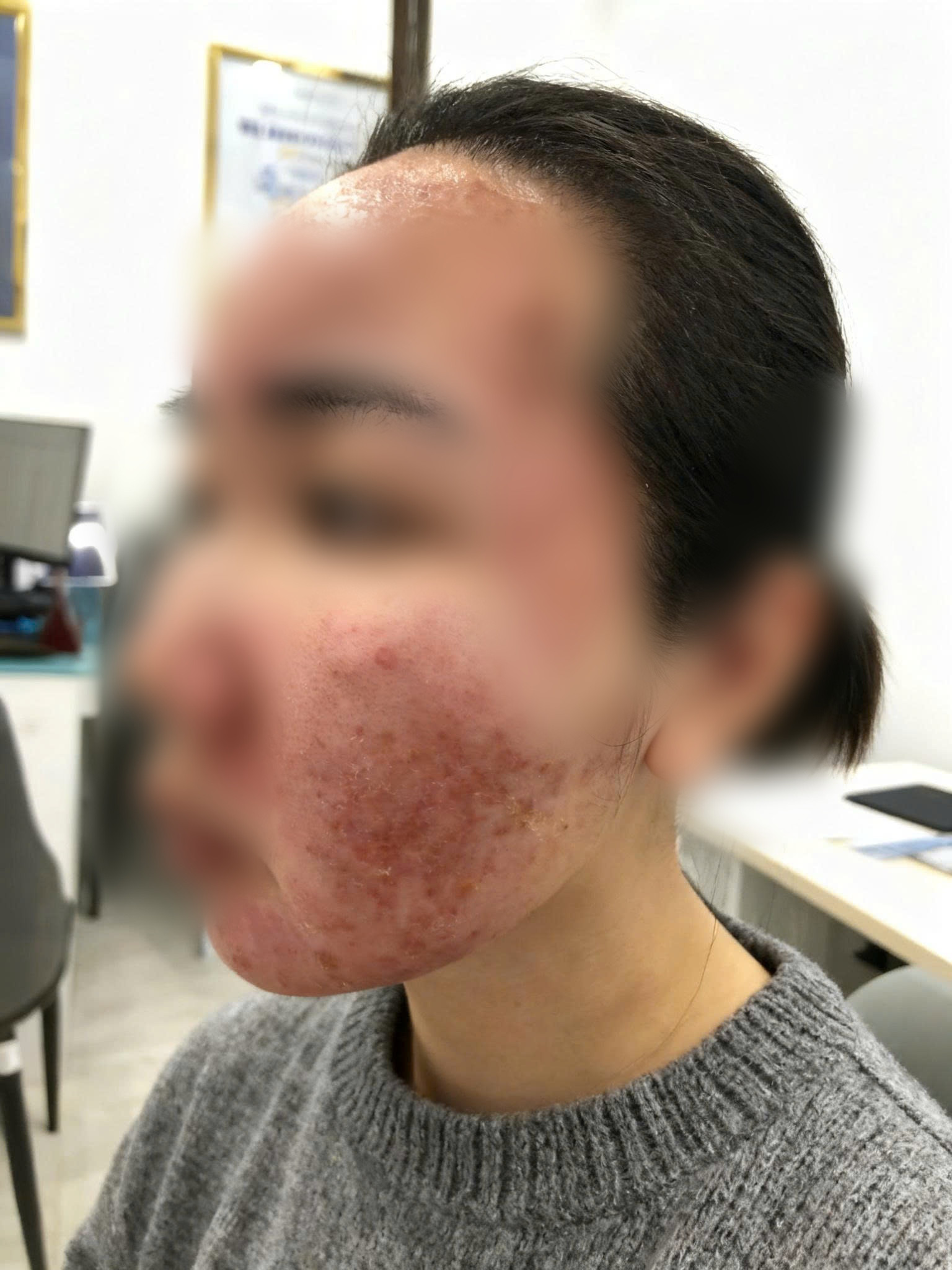 Cơn ác mộng của thiếu nữ chỉ sau vài giờ được mời làm đẹp cấp tốc đón Tết - Ảnh 1.