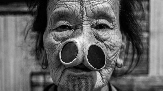 Làm đẹp kinh dị: